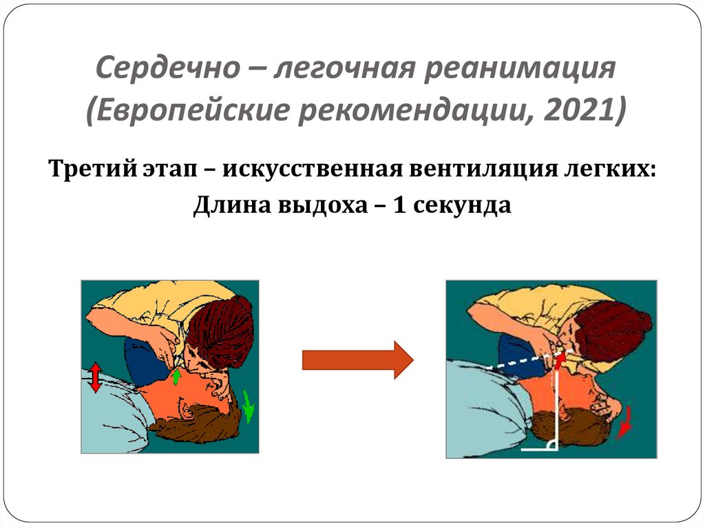 Сердечно – легочная реанимация (Европейские рекомендации, 2021)