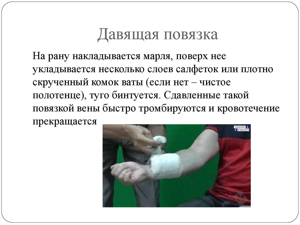 Давящая повязка