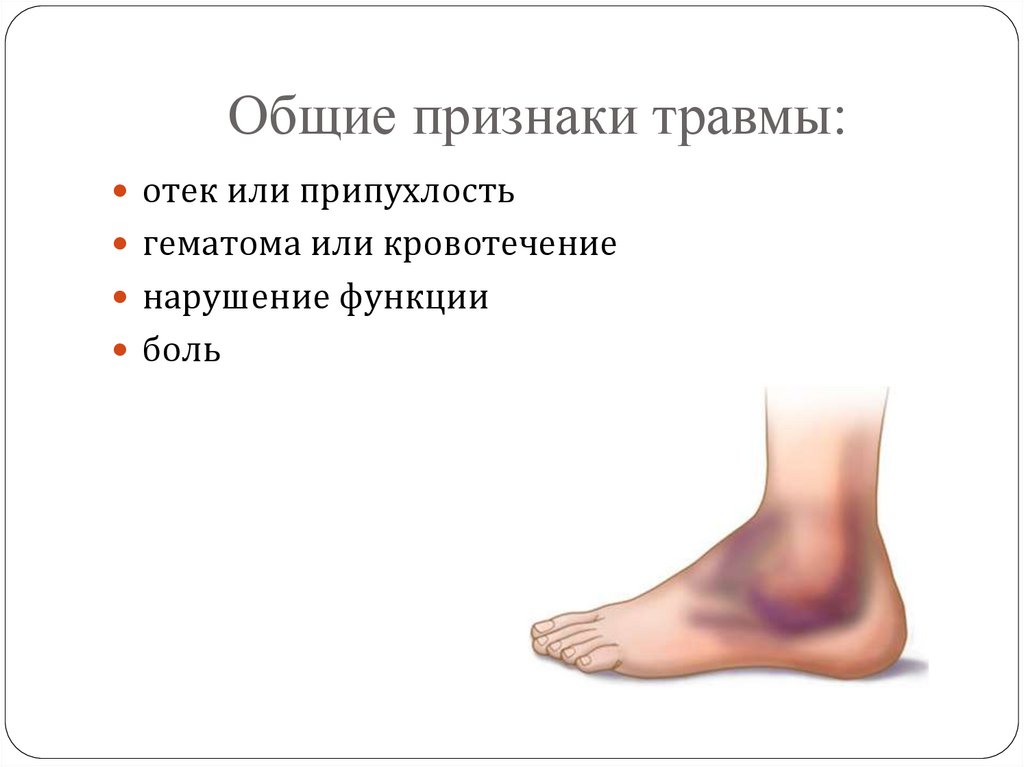 Общие признаки травмы: