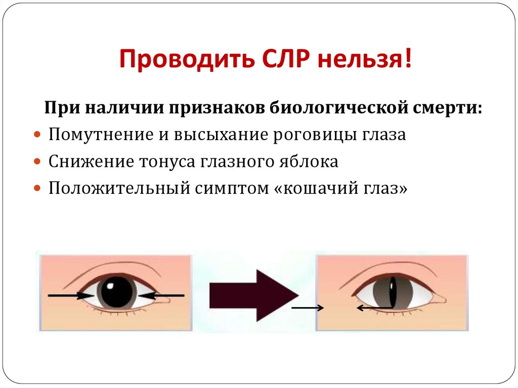 Проводить СЛР нельзя!