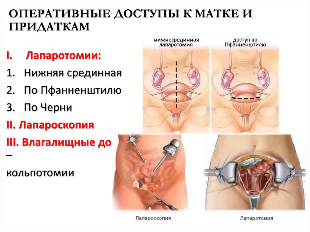 ОПЕРАТИВНЫЕ ДОСТУПЫ К МАТКЕ И ПРИДАТКАМ