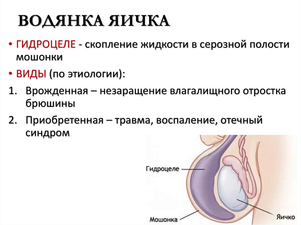 ВОДЯНКА ЯИЧКА