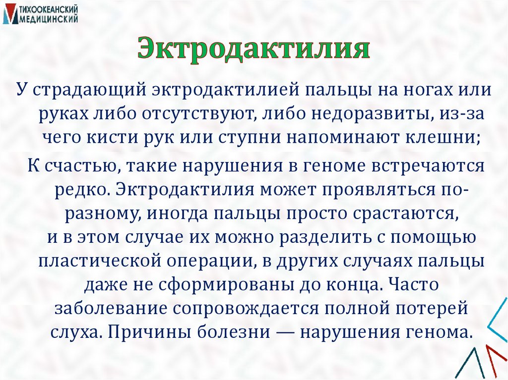 Эктродактилия