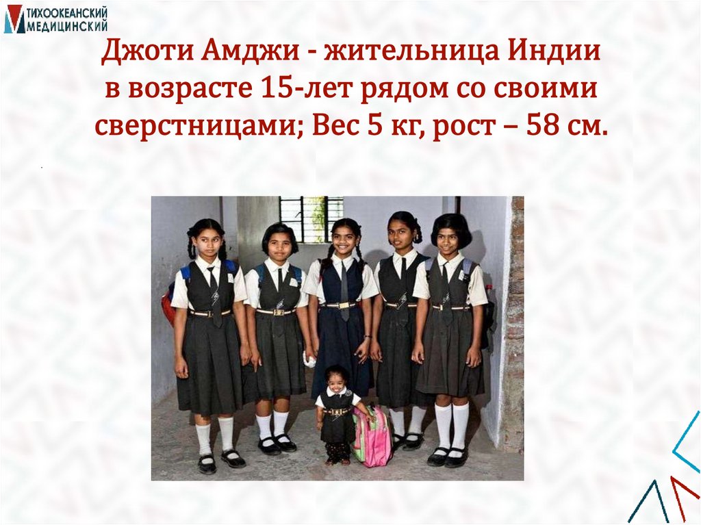 Джоти Амджи - жительница Индии в возрасте 15-лет рядом со своими сверстницами; Вес 5 кг, рост – 58 см.