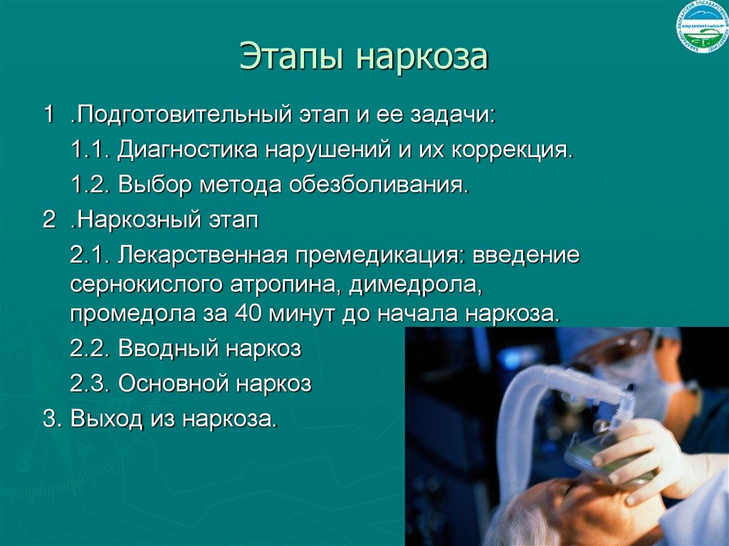 Этапы наркоза