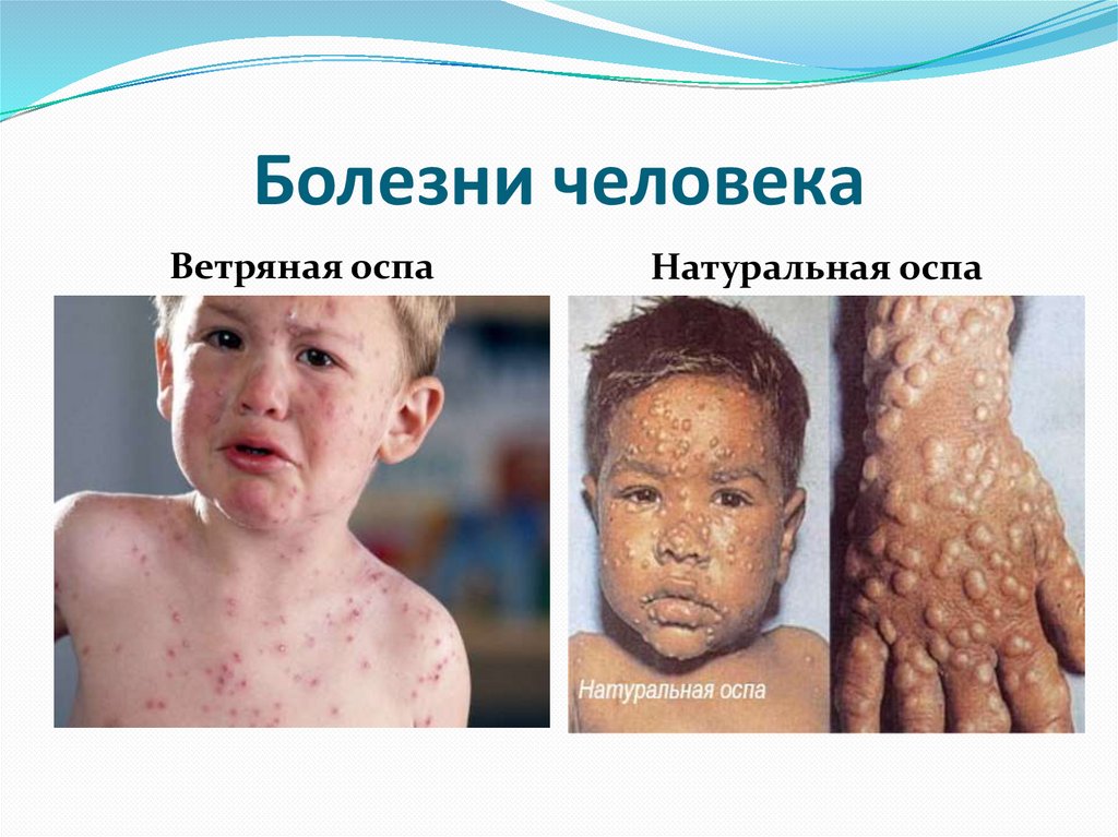 Болезни человека