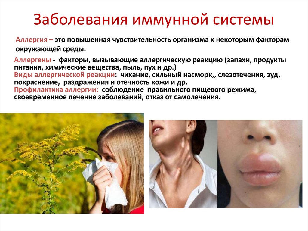 Заболевания иммунной системы