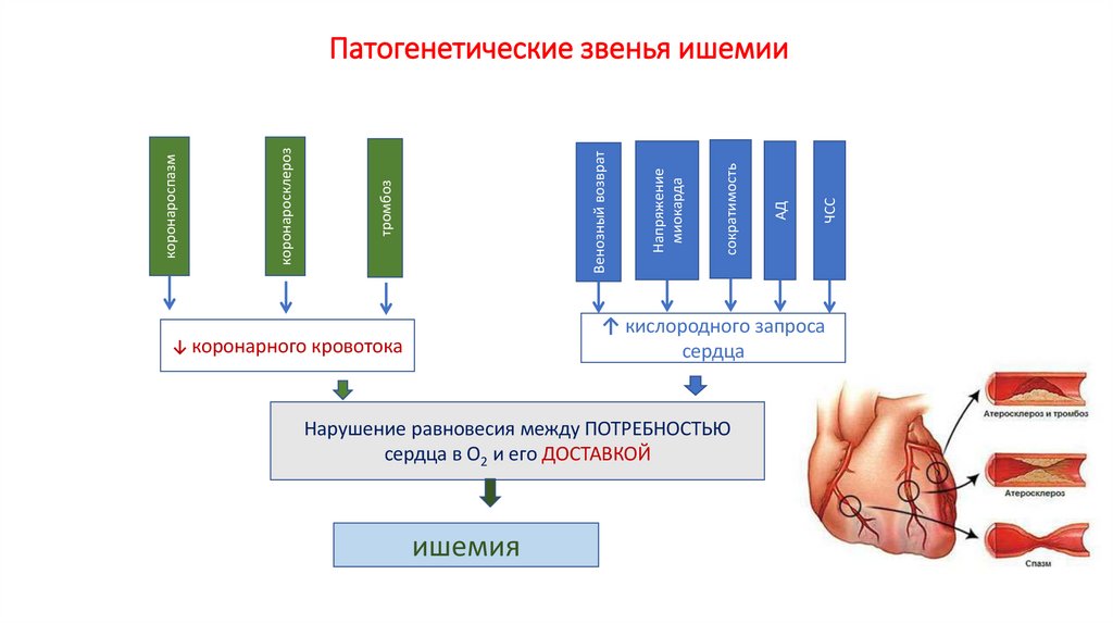Патогенетические звенья ишемии