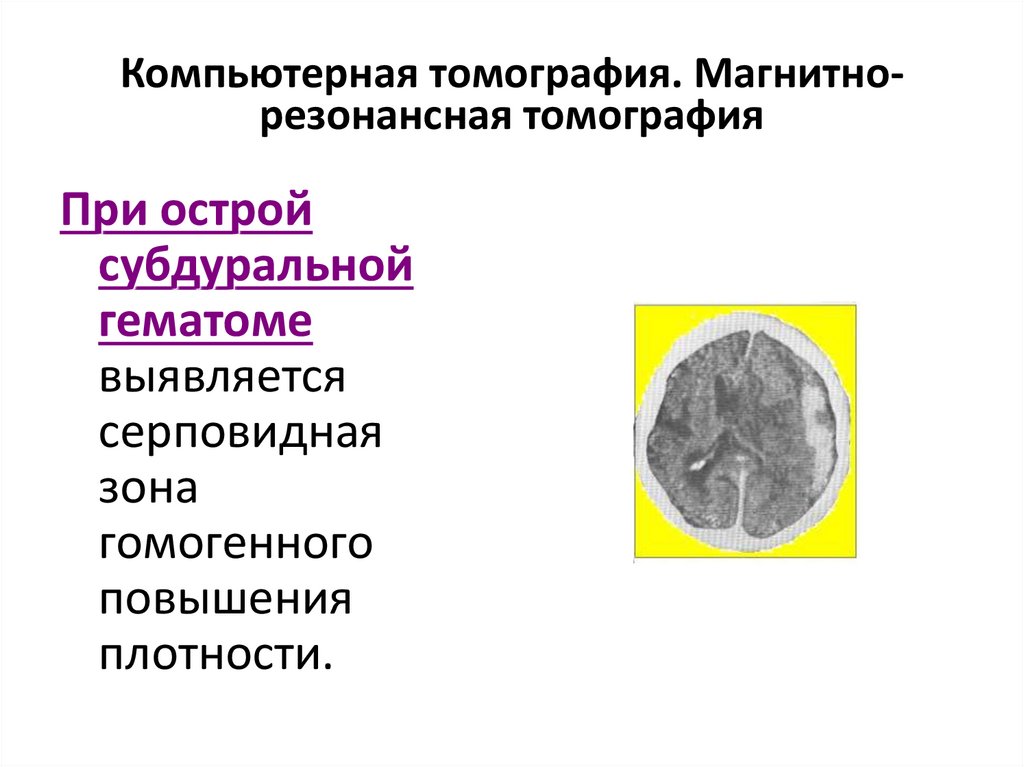 Компьютерная томография. Магнитно-резонансная томография