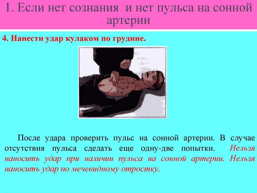 1. Если нет сознания и нет пульса на сонной артерии