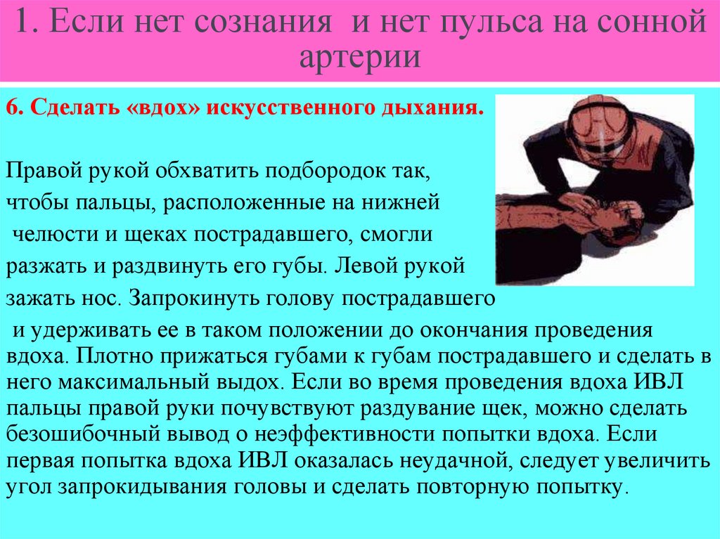 1. Если нет сознания и нет пульса на сонной артерии