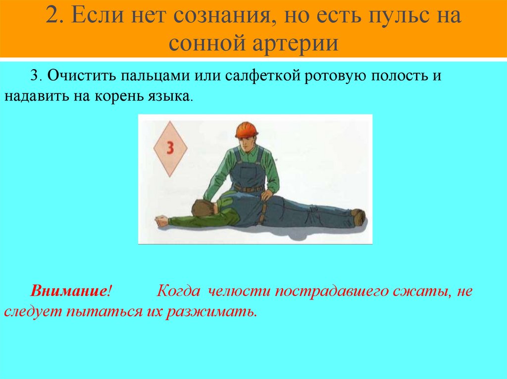2. Если нет сознания, но есть пульс на сонной артерии