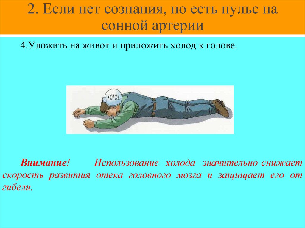 2. Если нет сознания, но есть пульс на сонной артерии