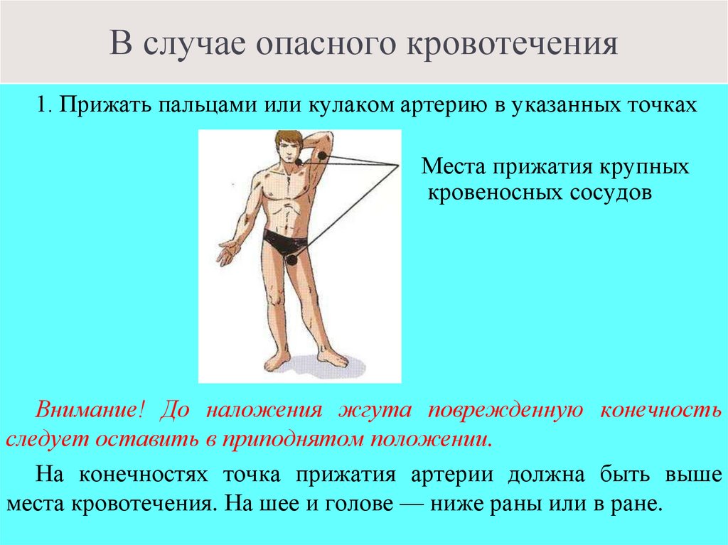 В случае опасного кровотечения