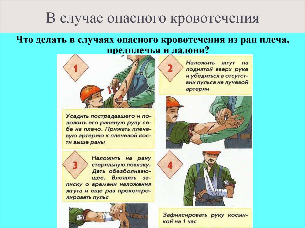 В случае опасного кровотечения