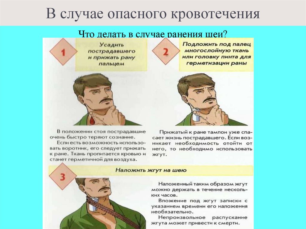 В случае опасного кровотечения