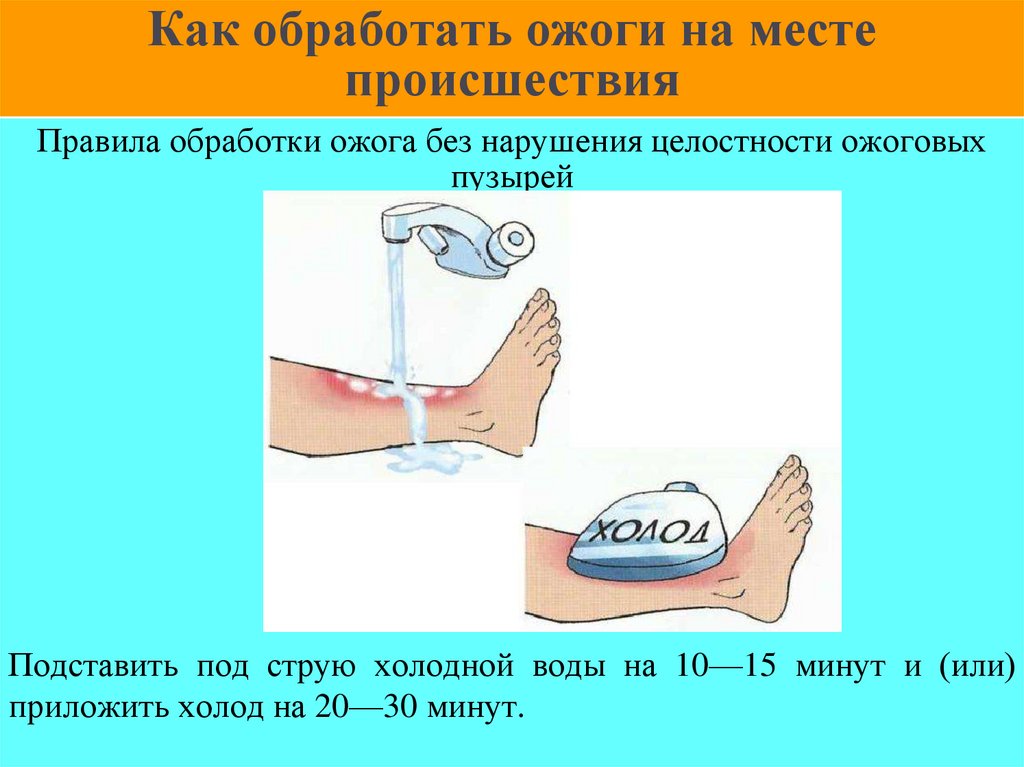 Как обработать ожоги на месте происшествия