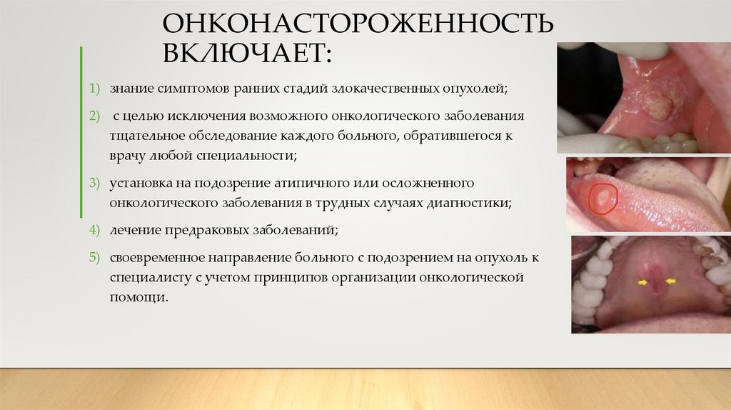 ОНКОНАСТОРОЖЕННОСТЬ ВКЛЮЧАЕТ: