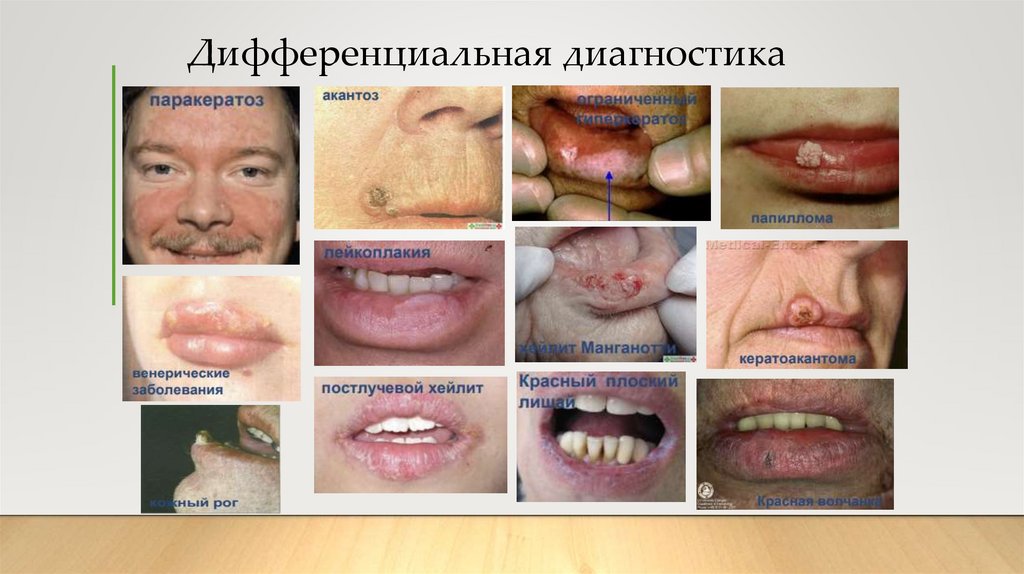 Дифференциальная диагностика