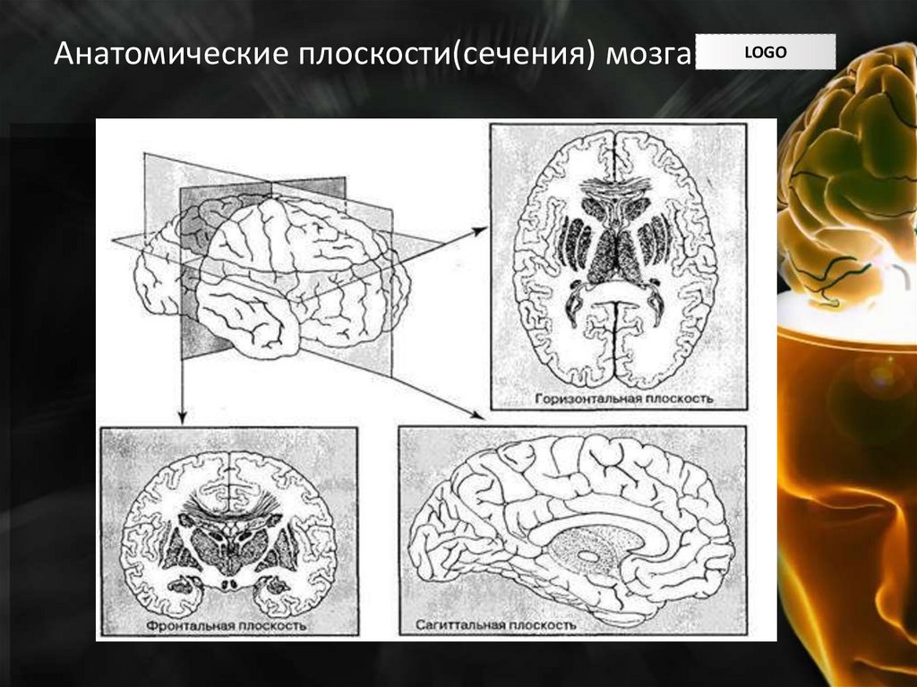Анатомические плоскости(сечения) мозга
