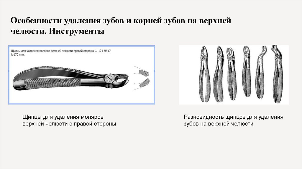 Особенности удаления зубов и корней зубов на верхней челюсти. Инструменты