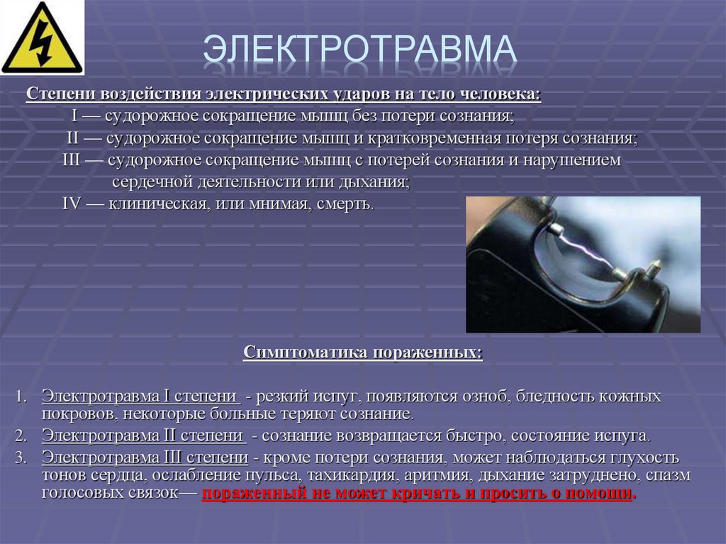 Электротравма