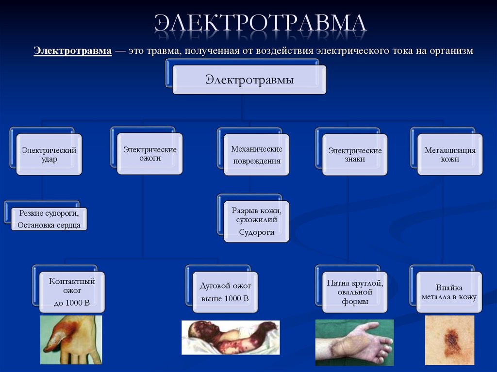 Электротравма