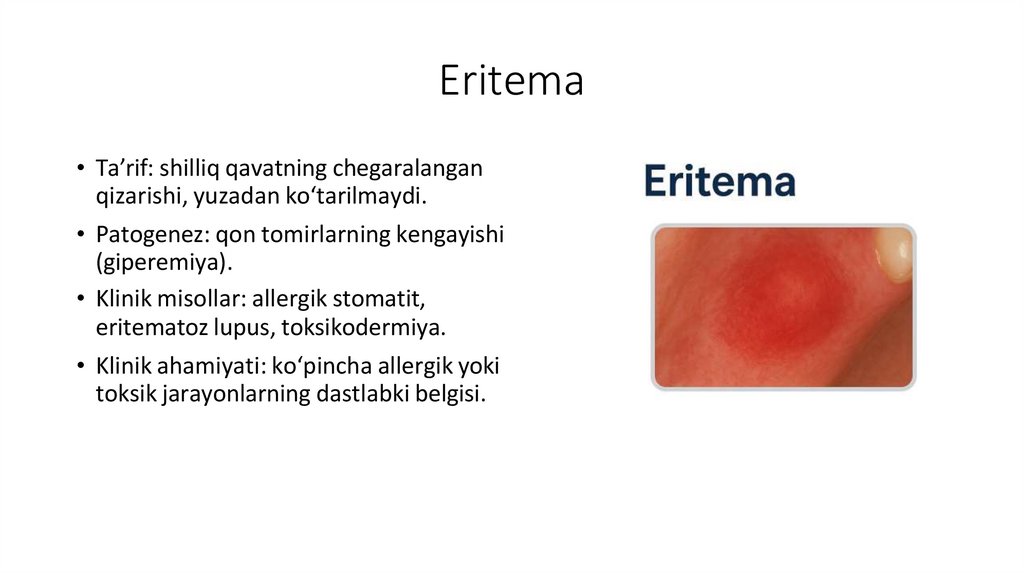 Eritema