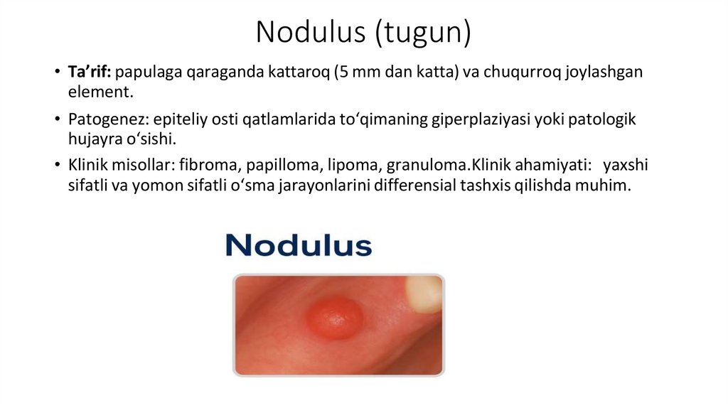 Nodulus (tugun)