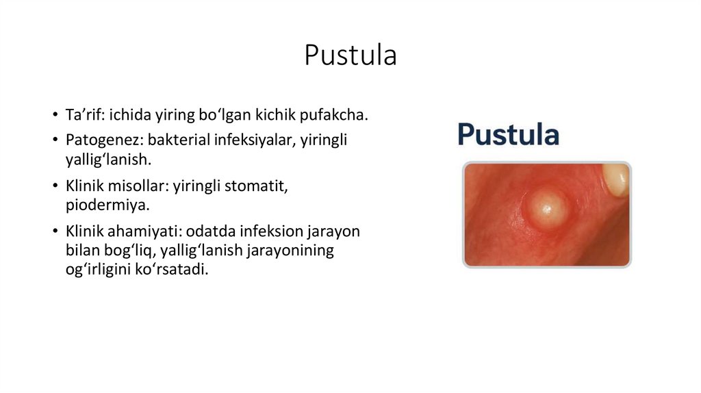 Pustula