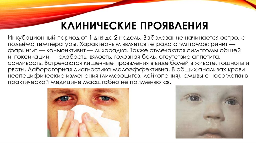 КЛИНИЧЕСКИЕ ПРОЯВЛЕНИЯ