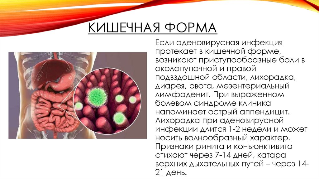 Кишечная форма