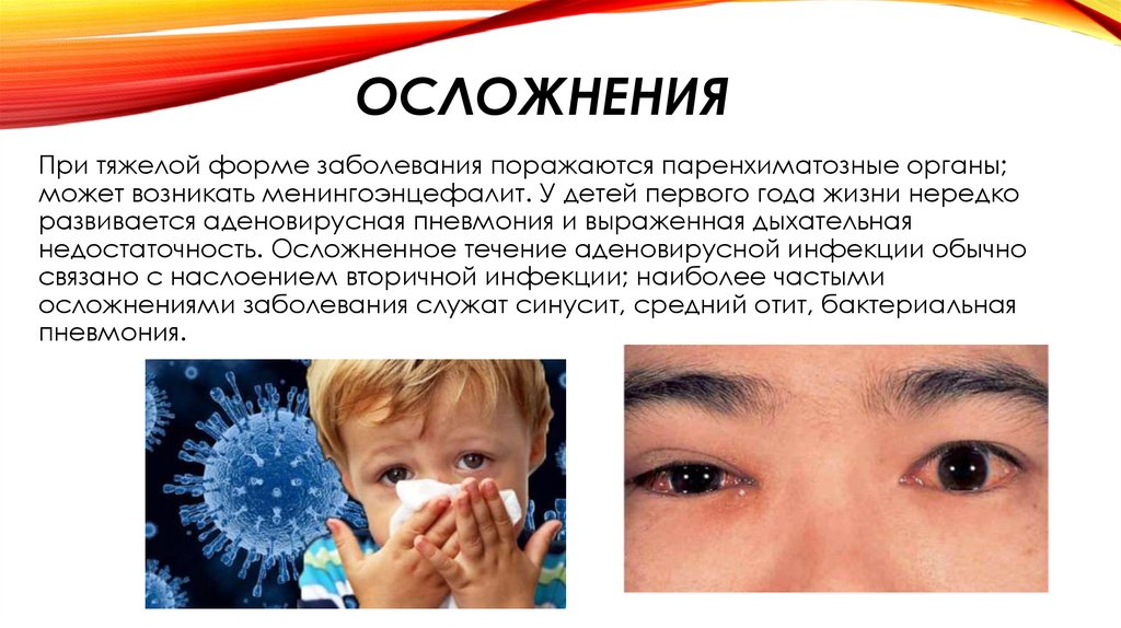 ОСЛОЖНЕНИЯ