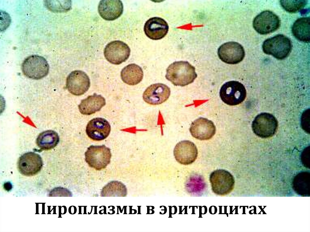 Пироплазмы в эритроцитах