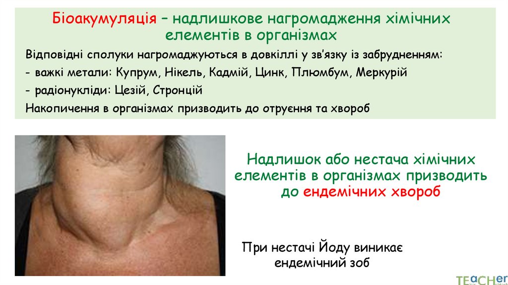 Біоакумуляція – надлишкове нагромадження хімічних елементів в організмах