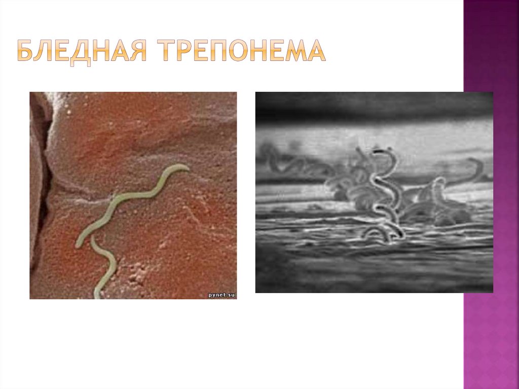 Бледная трепонема