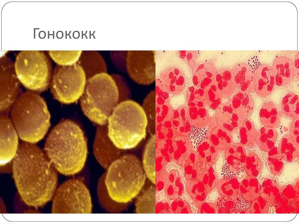 Гонококк