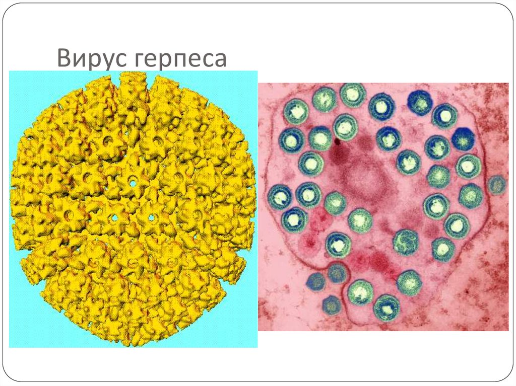Вирус герпеса
