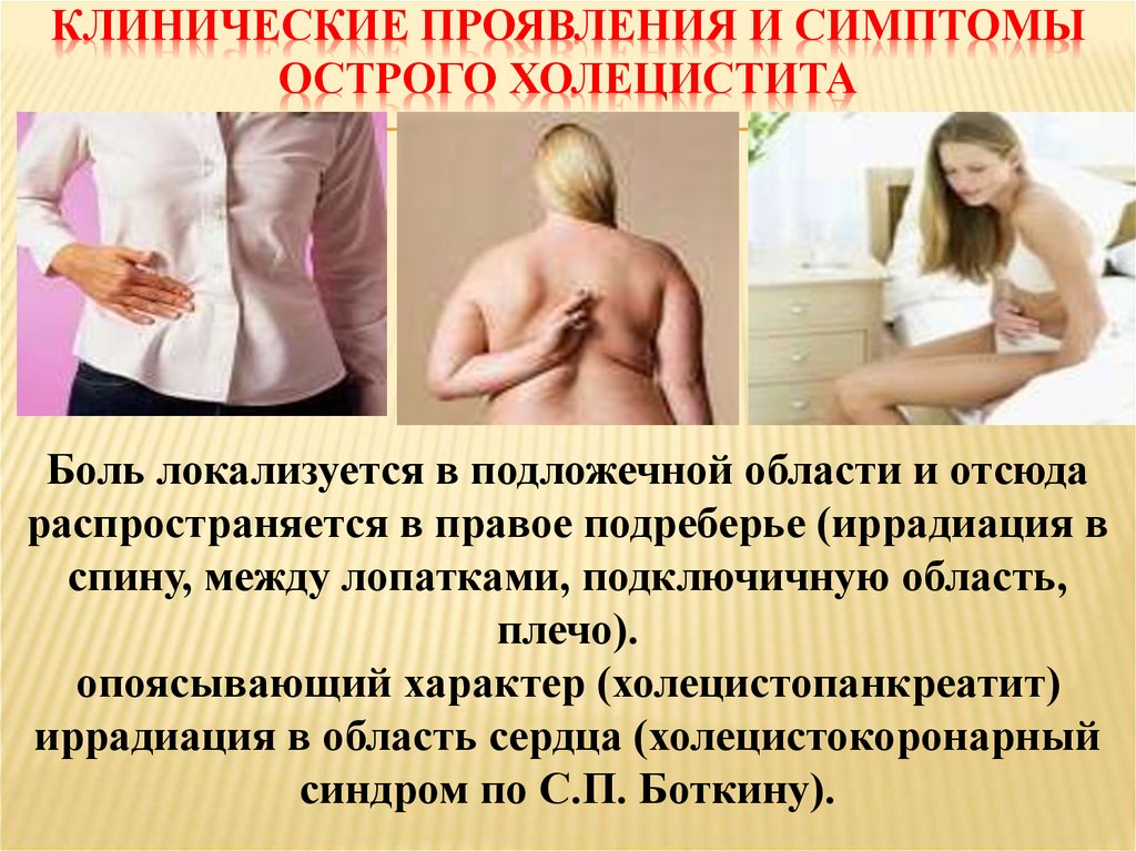 КЛИНИЧЕСКИЕ ПРОЯВЛЕНИЯ И СИМПТОМЫ ОСТРОГО ХОЛЕЦИСТИТА