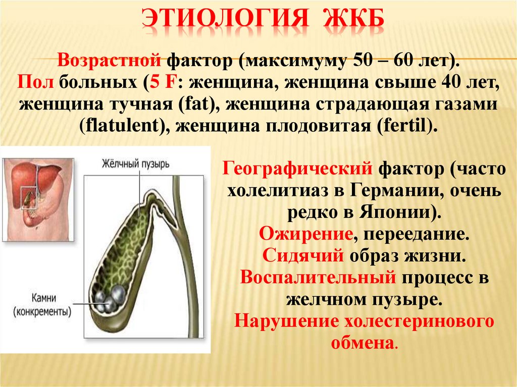 ЭТИОЛОГИЯ ЖКБ