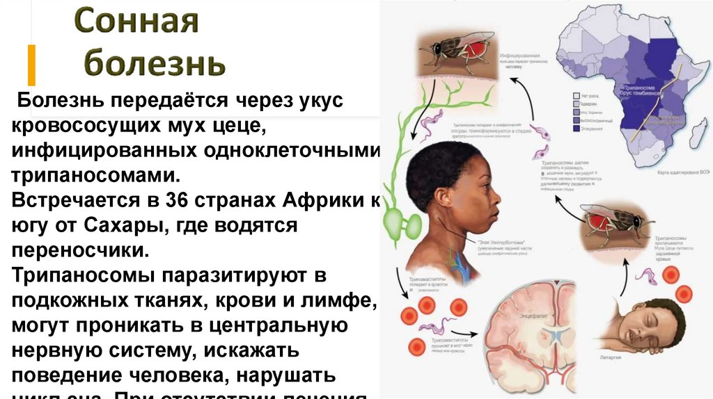 Сонная болезнь