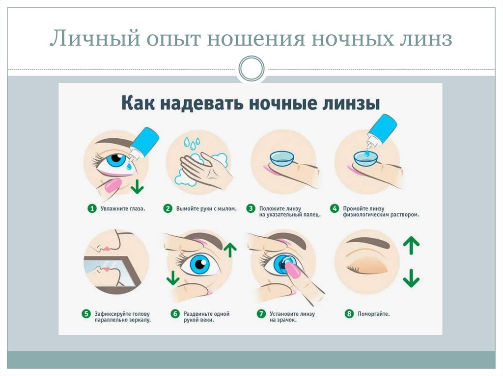 Личный опыт ношения ночных линз