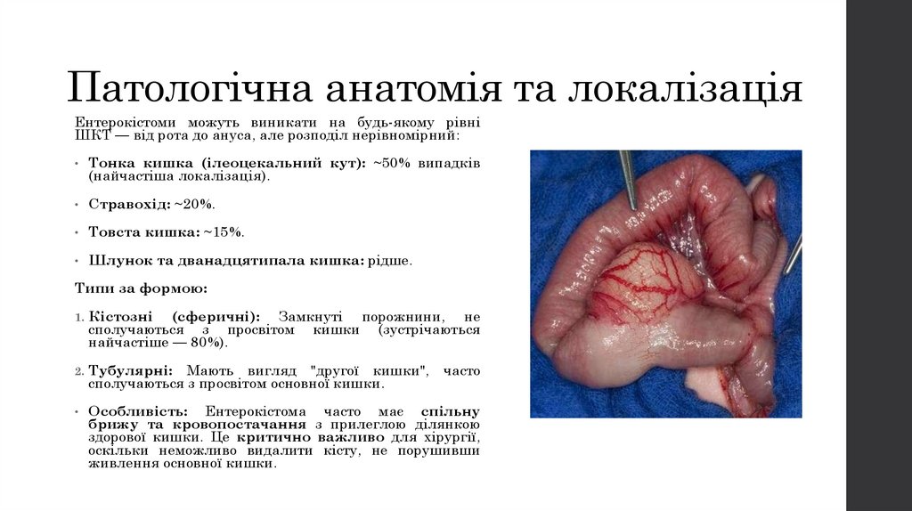 Патологічна анатомія та локалізація