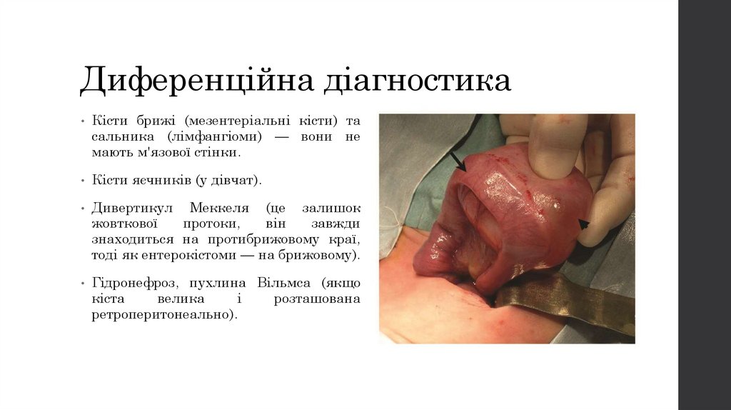 Диференційна діагностика