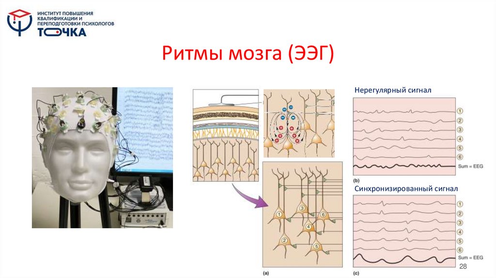 Ритмы мозга (ЭЭГ)
