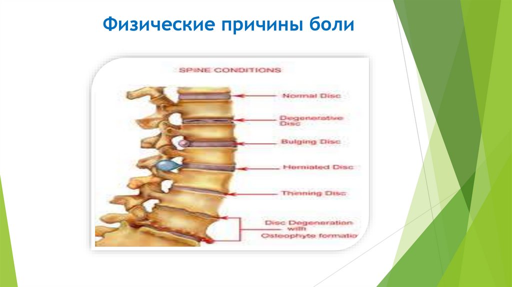 Физические причины боли