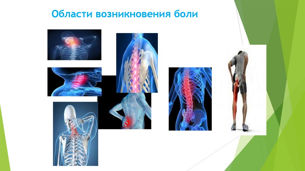Области возникновения боли