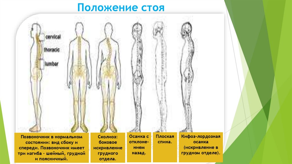 Положение стоя