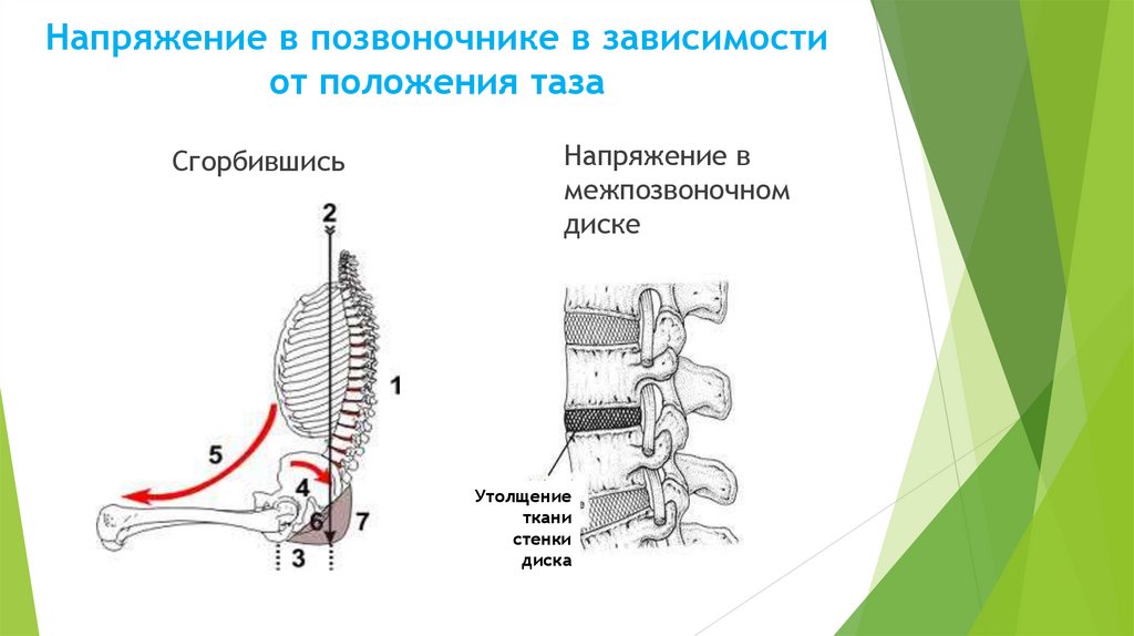 Напряжение в позвоночнике в зависимости от положения таза