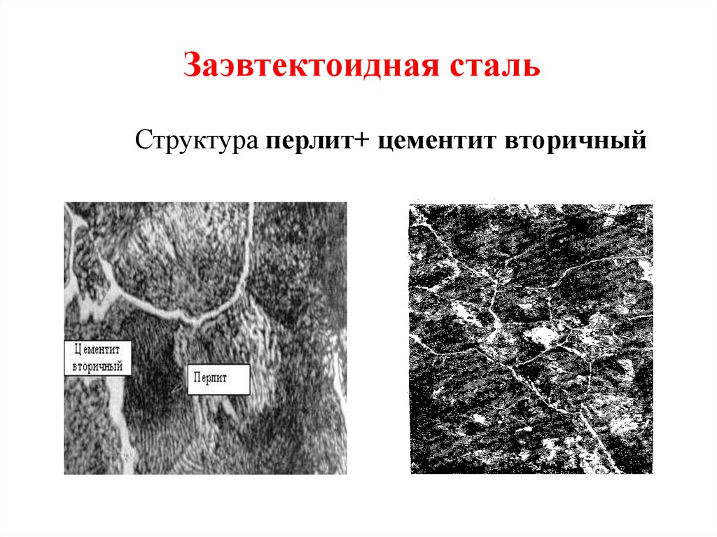 Заэвтектоидная сталь